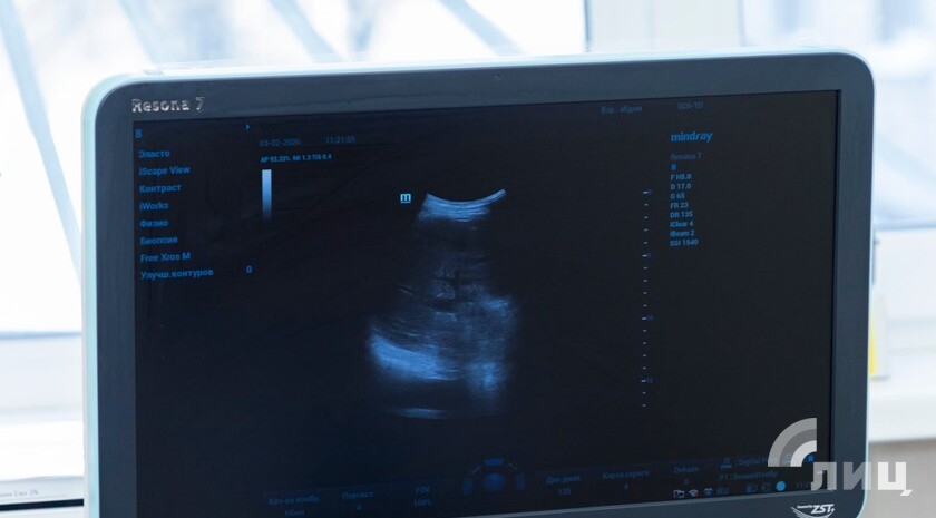 Фото: Луганский Информационный Центр/Дарья Чмирова